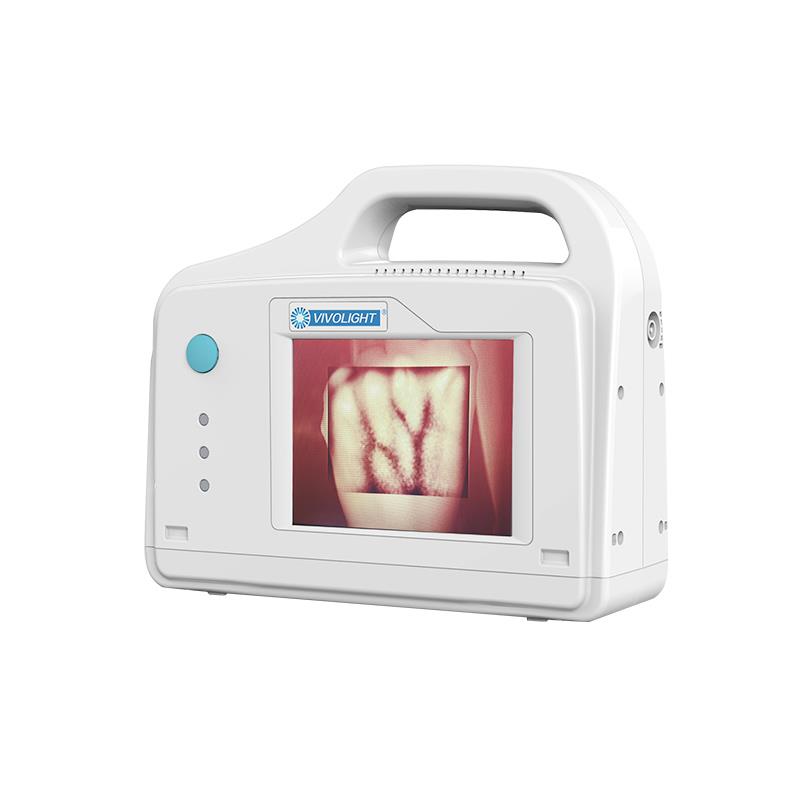 中科微影 VIVO200 屏显式血管显像仪