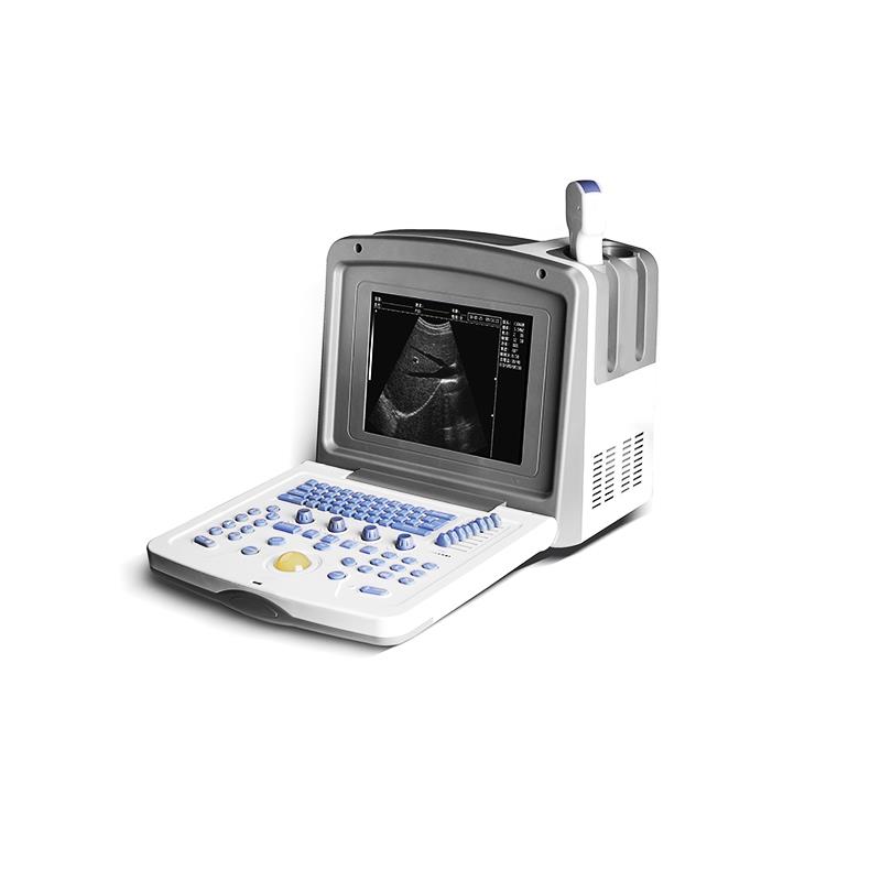 贝尔斯BLS-830便携式超声诊断仪（黑白B超）